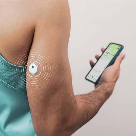 LinX CGM Sensor